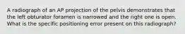 A radiograph of an AP projection of the pelvis demonstrates that the left obturator foramen is narrowed and the right one is open. What is the specific positioning error present on this radiograph?
