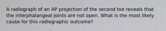 A radiograph of an AP projection of the second toe reveals that the interphalangeal joints are not open. What is the most likely cause for this radiographic outcome?