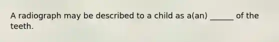 A radiograph may be described to a child as a(an) ______ of the teeth.