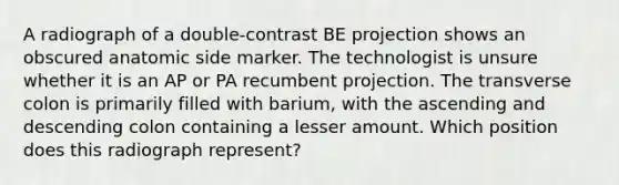 A radiograph of a double-contrast BE projection shows an obscured anatomic side marker. The technologist is unsure whether it is an AP or PA recumbent projection. The transverse colon is primarily filled with barium, with the ascending and descending colon containing a lesser amount. Which position does this radiograph represent?
