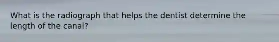 What is the radiograph that helps the dentist determine the length of the canal?