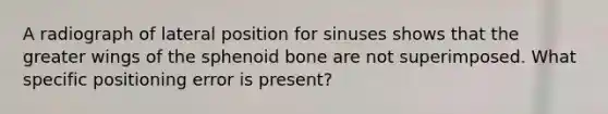 A radiograph of lateral position for sinuses shows that the greater wings of the sphenoid bone are not superimposed. What specific positioning error is present?