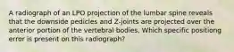 A radiograph of an LPO projection of the lumbar spine reveals that the downside pedicles and Z-joints are projected over the anterior portion of the vertebral bodies, Which specific positiong error is present on this radiograph?