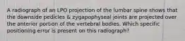 A radiograph of an LPO projection of the lumbar spine shows that the downside pedicles & zygapophyseal joints are projected over the anterior portion of the vertebral bodies. Which specific positioning error is present on this radiograph?