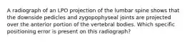 A radiograph of an LPO projection of the lumbar spine shows that the downside pedicles and zygopophyseal joints are projected over the anterior portion of the vertebral bodies. Which specific positioning error is present on this radiograph?