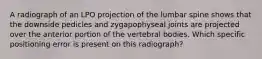 A radiograph of an LPO projection of the lumbar spine shows that the downside pedicles and zygapophyseal joints are projected over the anterior portion of the vertebral bodies. Which specific positioning error is present on this radiograph?