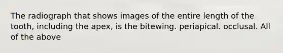 The radiograph that shows images of the entire length of the tooth, including the apex, is the bitewing. periapical. occlusal. All of the above