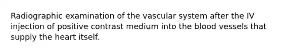 Radiographic examination of the vascular system after the IV injection of positive contrast medium into the blood vessels that supply the heart itself.