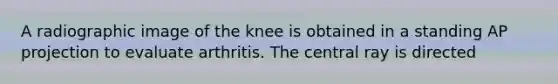 A radiographic image of the knee is obtained in a standing AP projection to evaluate arthritis. The central ray is directed