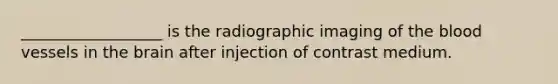 __________________ is the radiographic imaging of <a href='https://www.questionai.com/knowledge/k7oXMfj7lk-the-blood' class='anchor-knowledge'>the blood</a> vessels in <a href='https://www.questionai.com/knowledge/kLMtJeqKp6-the-brain' class='anchor-knowledge'>the brain</a> after injection of contrast medium.