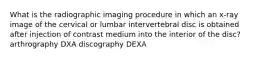 What is the radiographic imaging procedure in which an x-ray image of the cervical or lumbar intervertebral disc is obtained after injection of contrast medium into the interior of the disc? arthrography DXA discography DEXA