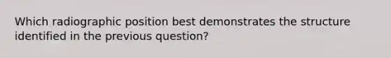 Which radiographic position best demonstrates the structure identified in the previous question?