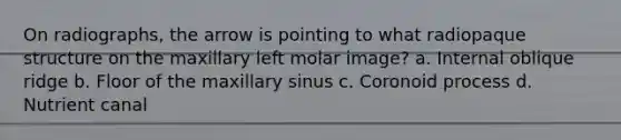 On radiographs, the arrow is pointing to what radiopaque structure on the maxillary left molar image? a. Internal oblique ridge b. Floor of the maxillary sinus c. Coronoid process d. Nutrient canal