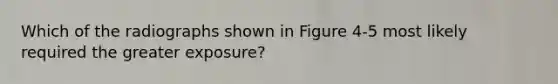 Which of the radiographs shown in Figure 4-5 most likely required the greater exposure?