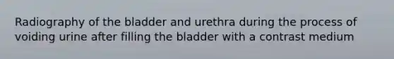 Radiography of the bladder and urethra during the process of voiding urine after filling the bladder with a contrast medium