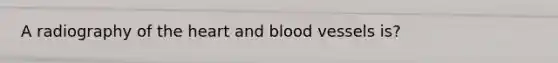 A radiography of the heart and blood vessels is?