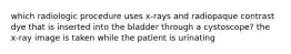 which radiologic procedure uses x-rays and radiopaque contrast dye that is inserted into the bladder through a cystoscope? the x-ray image is taken while the patient is urinating