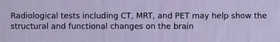 Radiological tests including CT, MRT, and PET may help show the structural and functional changes on the brain