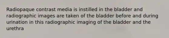 Radiopaque contrast media is instilled in the bladder and radiographic images are taken of the bladder before and during urination in this radiographic imaging of the bladder and the urethra