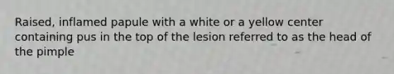 Raised, inflamed papule with a white or a yellow center containing pus in the top of the lesion referred to as the head of the pimple