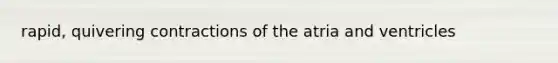 rapid, quivering contractions of the atria and ventricles