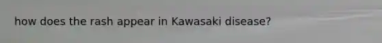 how does the rash appear in Kawasaki disease?