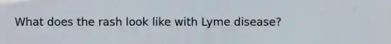 What does the rash look like with Lyme disease?