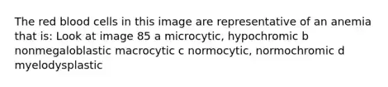 The red blood cells in this image are representative of an anemia that is: Look at image 85 a microcytic, hypochromic b nonmegaloblastic macrocytic c normocytic, normochromic d myelodysplastic