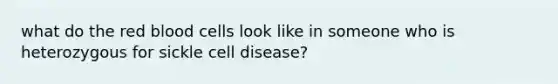 what do the red blood cells look like in someone who is heterozygous for sickle cell disease?