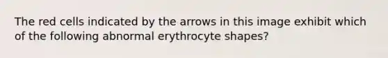 The red cells indicated by the arrows in this image exhibit which of the following abnormal erythrocyte shapes?