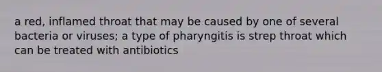 a red, inflamed throat that may be caused by one of several bacteria or viruses; a type of pharyngitis is strep throat which can be treated with antibiotics