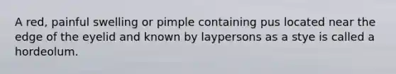 A red, painful swelling or pimple containing pus located near the edge of the eyelid and known by laypersons as a stye is called a hordeolum.