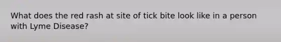 What does the red rash at site of tick bite look like in a person with Lyme Disease?