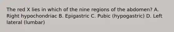 The red X lies in which of the nine regions of the abdomen? A. Right hypochondriac B. Epigastric C. Pubic (hypogastric) D. Left lateral (lumbar)