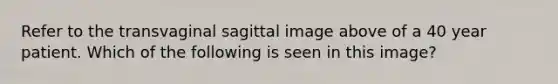 Refer to the transvaginal sagittal image above of a 40 year patient. Which of the following is seen in this image?