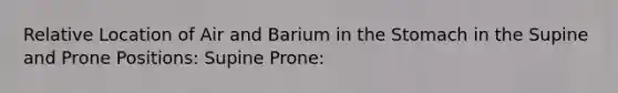 Relative Location of Air and Barium in the Stomach in the Supine and Prone Positions: Supine Prone: