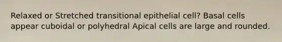 Relaxed or Stretched transitional epithelial cell? Basal cells appear cuboidal or polyhedral Apical cells are large and rounded.