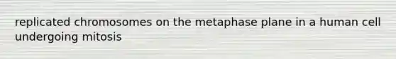 replicated chromosomes on the metaphase plane in a human cell undergoing mitosis