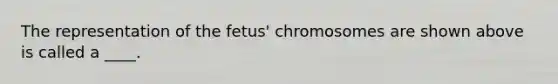 The representation of the fetus' chromosomes are shown above is called a ____.