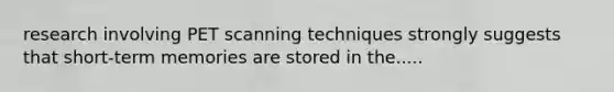 research involving PET scanning techniques strongly suggests that short-term memories are stored in the.....