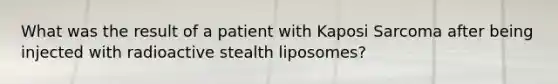 What was the result of a patient with Kaposi Sarcoma after being injected with radioactive stealth liposomes?