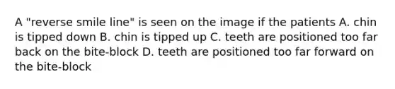 A "reverse smile line" is seen on the image if the patients A. chin is tipped down B. chin is tipped up C. teeth are positioned too far back on the bite-block D. teeth are positioned too far forward on the bite-block