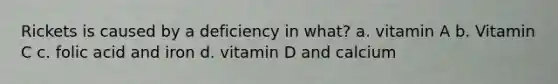 Rickets is caused by a deficiency in what? a. vitamin A b. Vitamin C c. folic acid and iron d. vitamin D and calcium