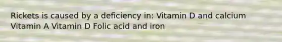 Rickets is caused by a deficiency in: Vitamin D and calcium Vitamin A Vitamin D Folic acid and iron