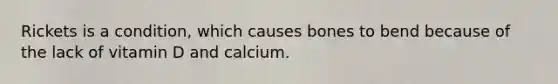 Rickets is a condition, which causes bones to bend because of the lack of vitamin D and calcium.