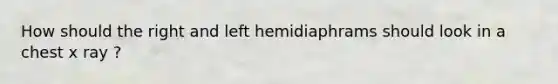 How should the right and left hemidiaphrams should look in a chest x ray ?