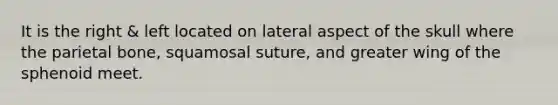 It is the right & left located on lateral aspect of the skull where the parietal bone, squamosal suture, and greater wing of the sphenoid meet.