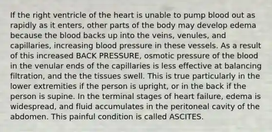 If the right ventricle of <a href='https://www.questionai.com/knowledge/kya8ocqc6o-the-heart' class='anchor-knowledge'>the heart</a> is unable to pump blood out as rapidly as it enters, other parts of the body may develop edema because <a href='https://www.questionai.com/knowledge/k7oXMfj7lk-the-blood' class='anchor-knowledge'>the blood</a> backs up into the veins, venules, and capillaries, increasing <a href='https://www.questionai.com/knowledge/kD0HacyPBr-blood-pressure' class='anchor-knowledge'>blood pressure</a> in these vessels. As a result of this increased BACK PRESSURE, osmotic pressure of the blood in the venular ends of the capillaries is less effective at balancing filtration, and the the tissues swell. This is true particularly in the lower extremities if the person is upright, or in the back if the person is supine. In the terminal stages of heart failure, edema is widespread, and fluid accumulates in the peritoneal cavity of the abdomen. This painful condition is called ASCITES.