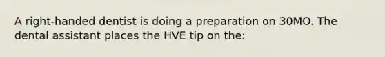 A right-handed dentist is doing a preparation on 30MO. The dental assistant places the HVE tip on the: