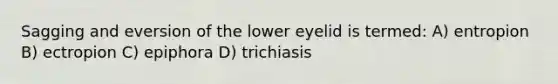 Sagging and eversion of the lower eyelid is termed: A) entropion B) ectropion C) epiphora D) trichiasis